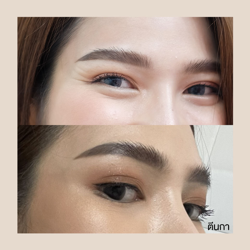 Botox Allergan 100U ボトックス アメリカ 注射部位を選択可能 Only Asok