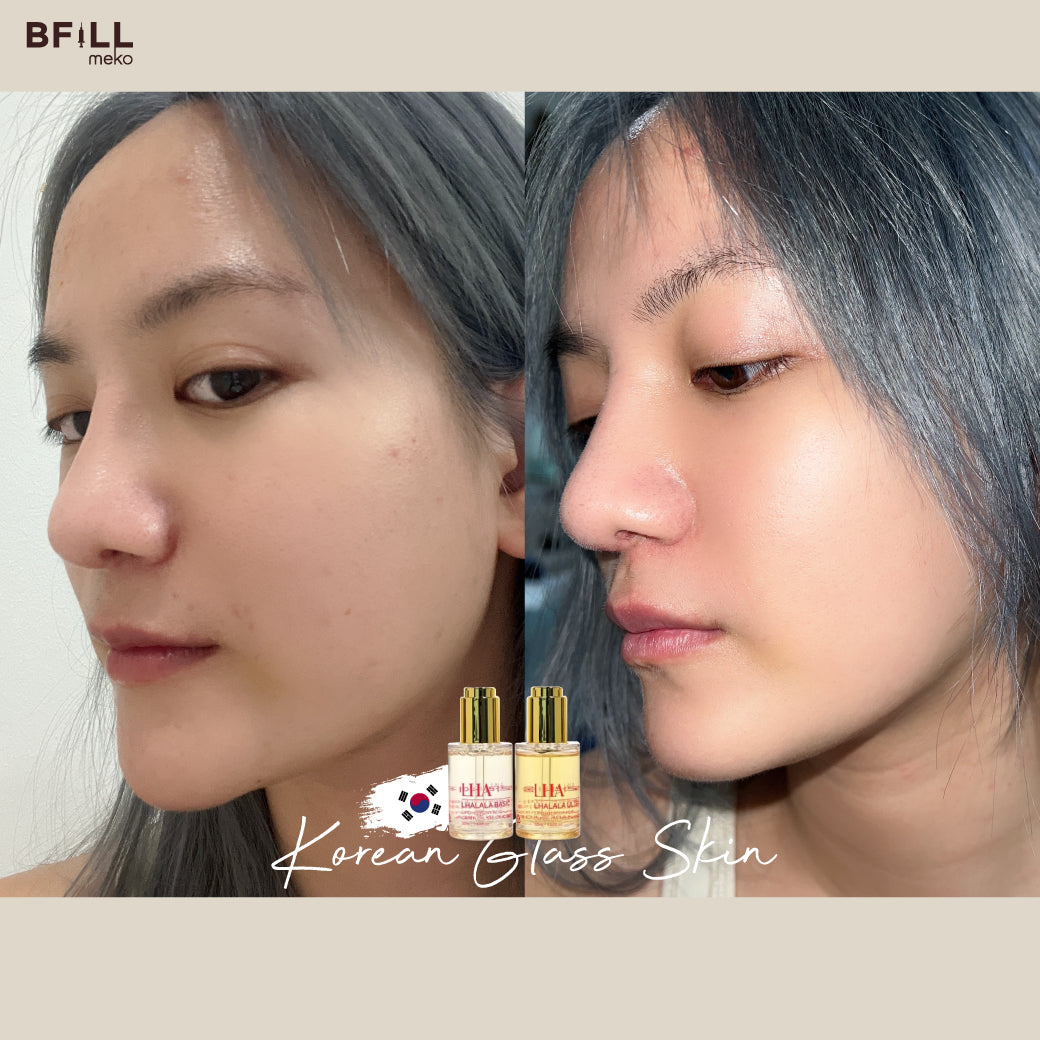 DUO Treatment + IV Drip ทรีตเม้นต์พร้อมดริปผิว ทำพร้อมกัน เฉพาะ สาขาทองหล่อ