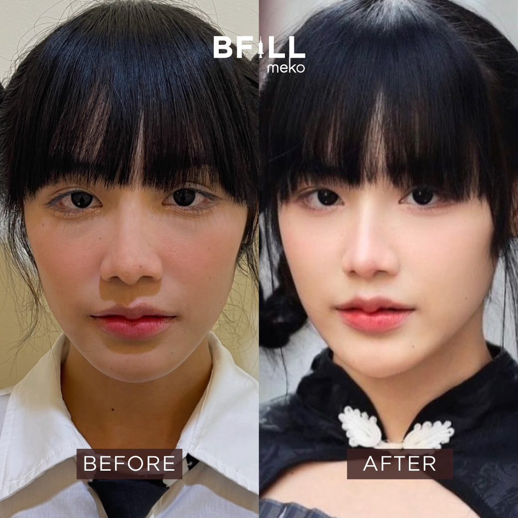 MADE Collagen 4 cc 16 points all over the face