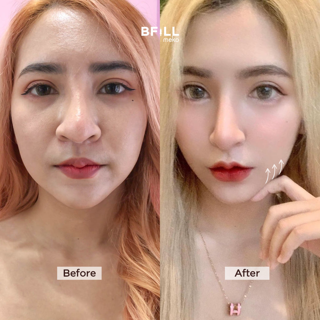 Package Super V V-shaped Face Set Best-selling Set Recommended Set
