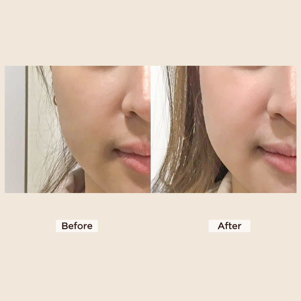Meso Neo Glutanex Glow Facial Injection with Pure Glutathione, New from Korea