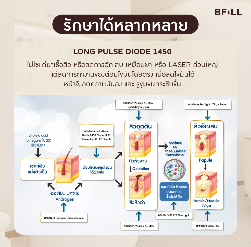 Program Acne Laser ทั่วหน้า or Pico Laser ทั่วหน้า Only Asok by Specialist