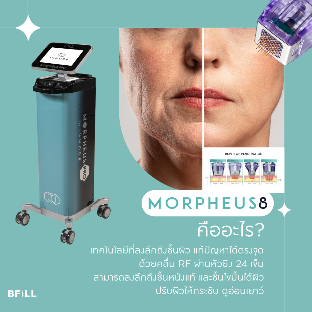 Morpheus8 Morpheus8 Free Anesthetic Only Asok (Unlimited Shots) Subject to Doctor's Evaluation