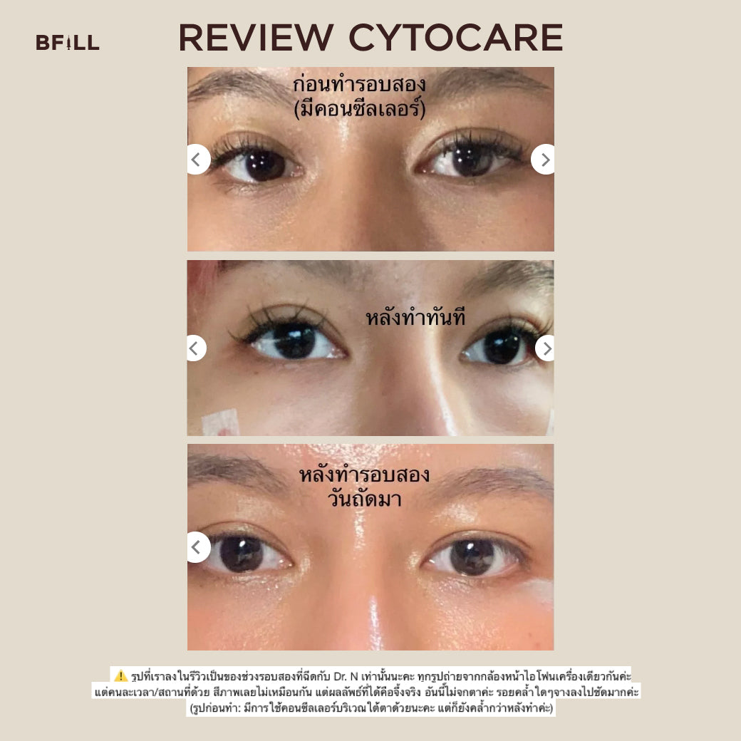 Cytocare サイトケア 肌の回復 くすんだ目の下の肌を明るくし、しわの溝を埋める