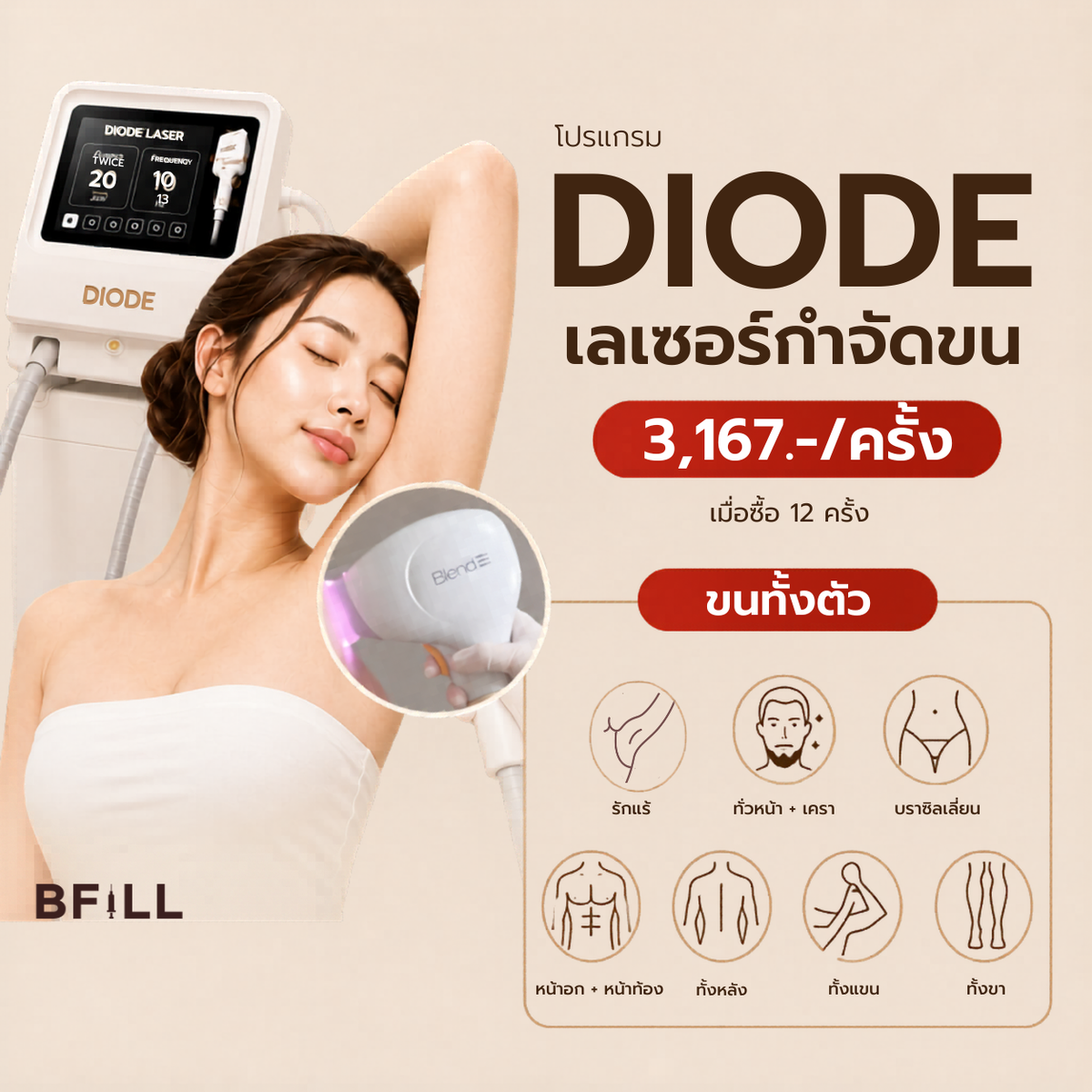 Diode全身脱毛项目,由资深专家操作(×2套餐时长)