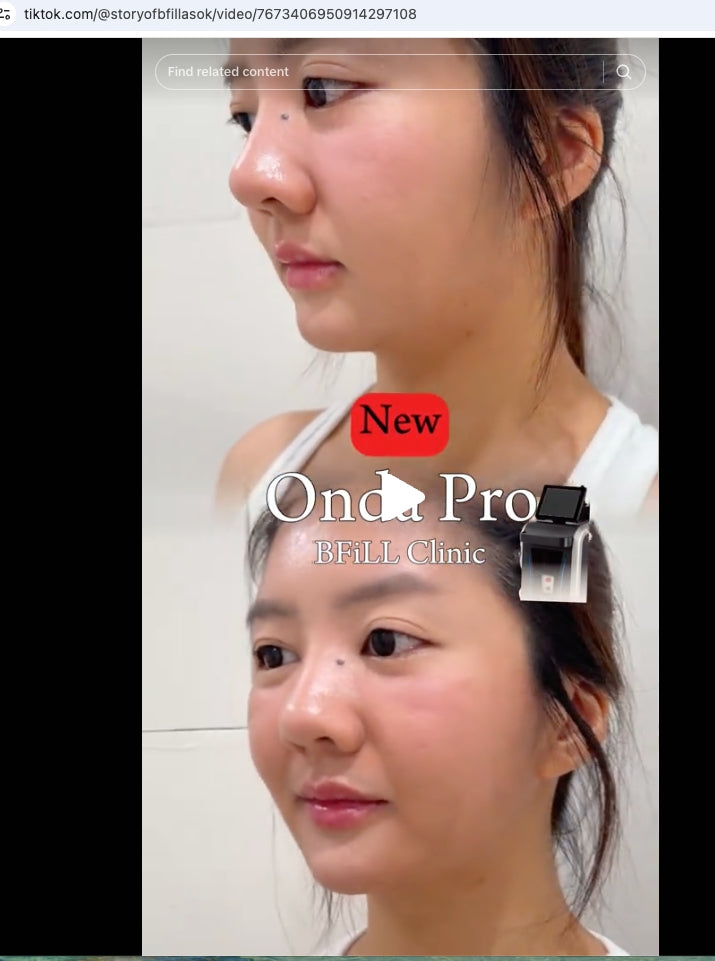 Onda Proプログラム（Lineでお問い合わせいただくと特別価格！）部分痩せ用脂肪分解マシンはアソーク院に設置、69年8月31日までの期間限定