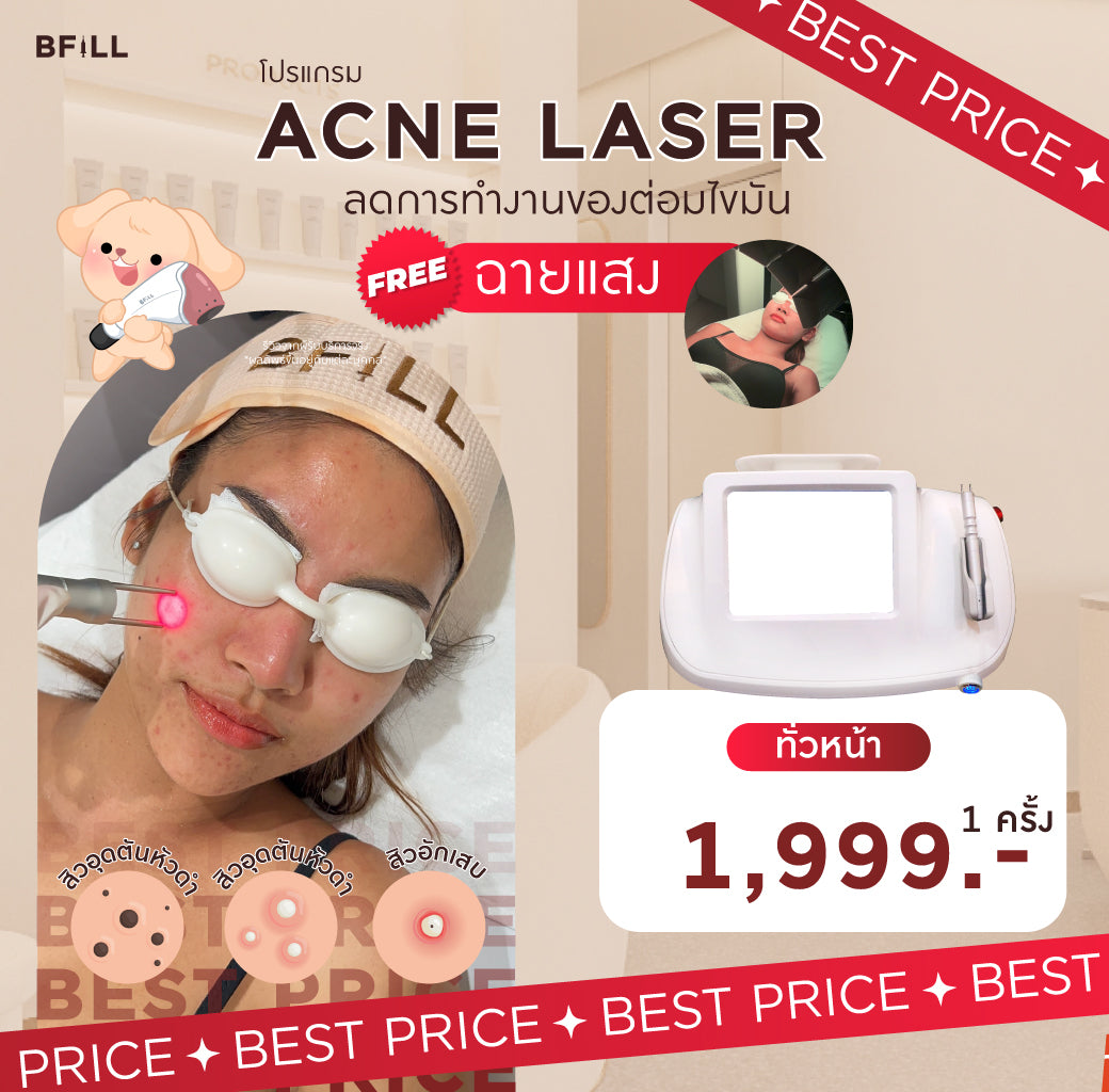 Program เลเซอร์กำจัดสิว Laser Only Asok