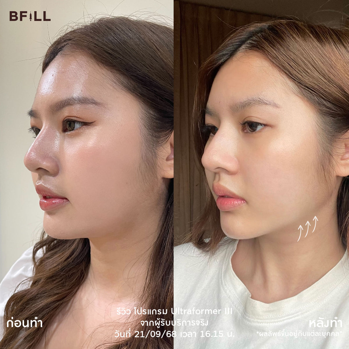 Program XeOliformer by Doctor Only Asok ทำพร้อมกันในวันเดียว