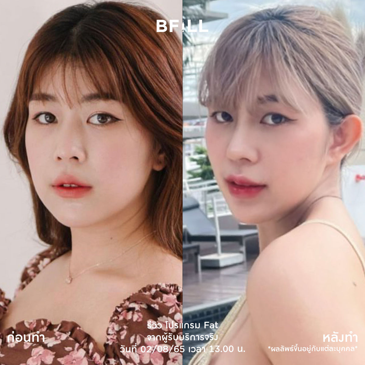 Program Fat Face Treatment: Cheeks and Double Chin Fat Reduction
