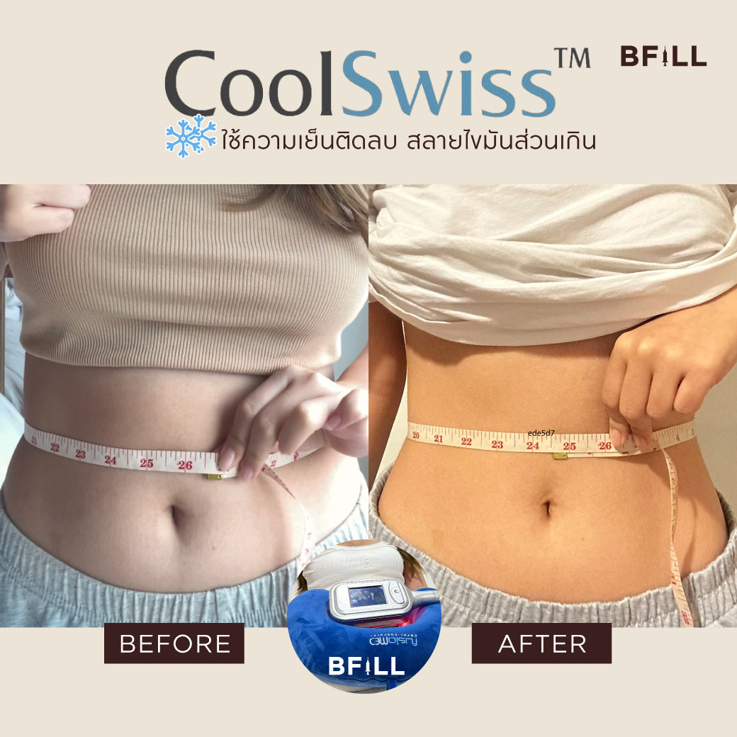 Coolswiss fat reduction with negative cold 1 trial pinch for customers who have never purchased 1 person/1 right only in Thonglor.