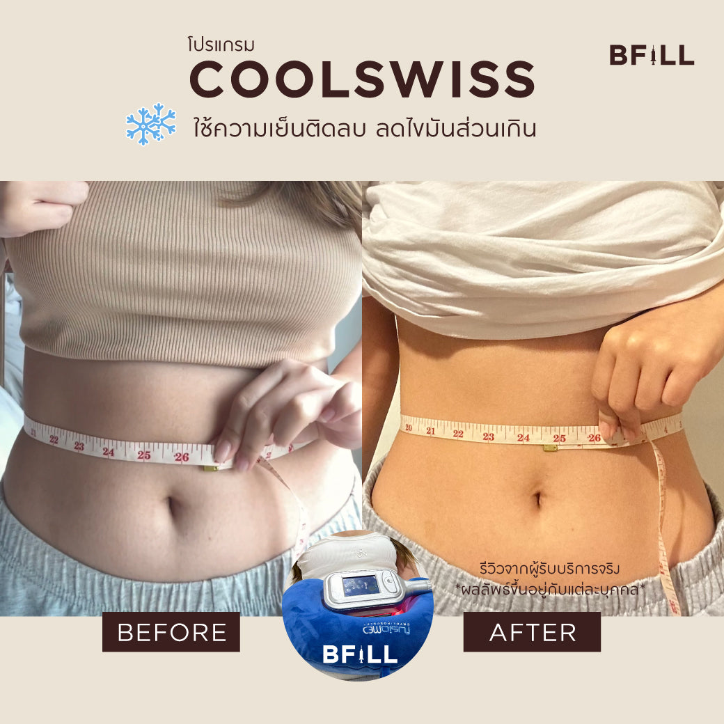Program Coolswiss ลดไขมันด้วยความเย็นติดลบ เฉพาะทองหล่อ