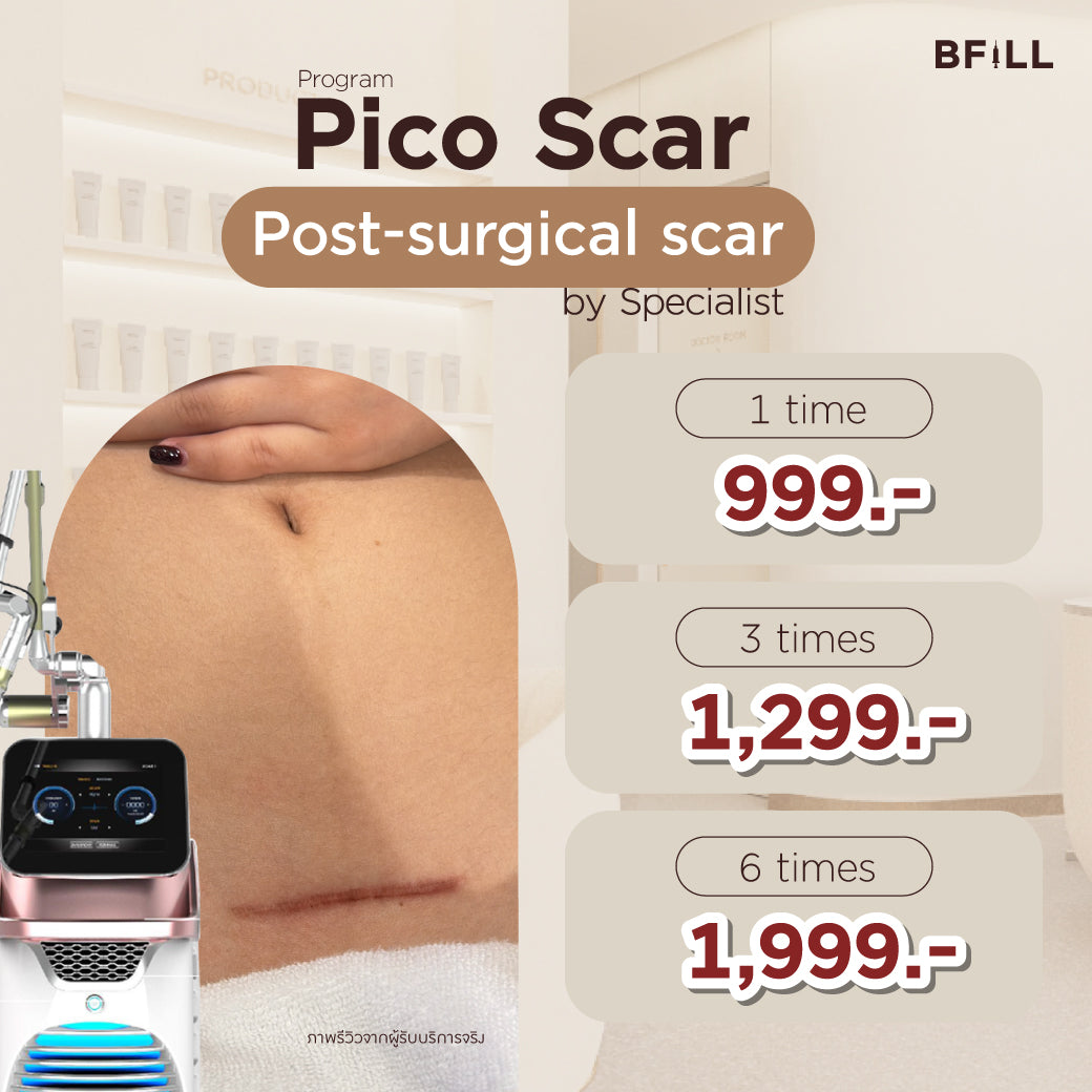 Pico Laser Facial reduces dark spots all over the face or rejuvenates acne scars all over the face by Doctor Only Asok