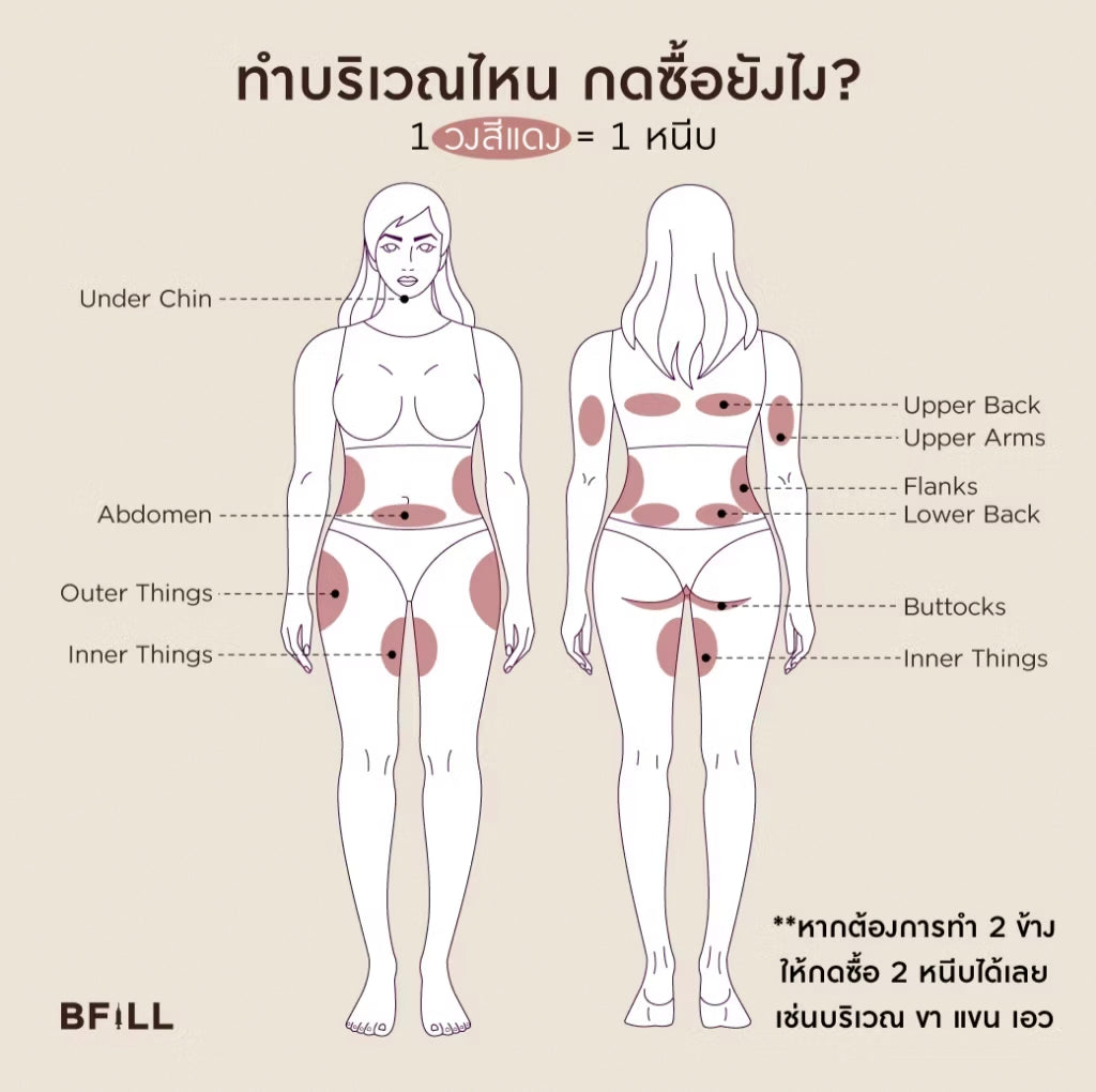 Program Coolswiss ลดไขมันด้วยความเย็นติดลบ เฉพาะทองหล่อ
